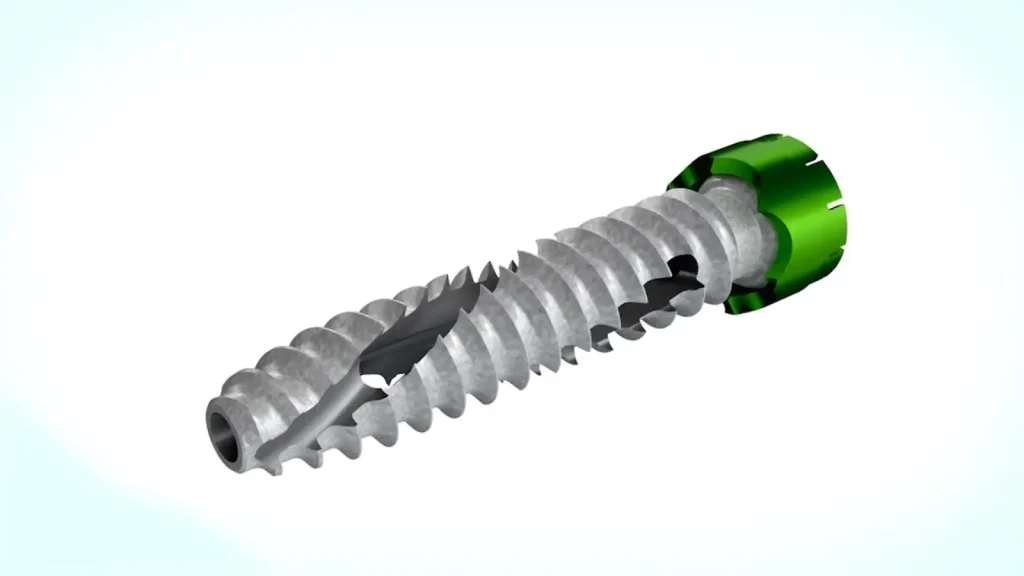 Alevio Spine Device